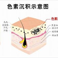  常见物质微量元素在体内沉积症状